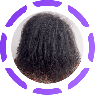 Cabelo ressecado e poroso